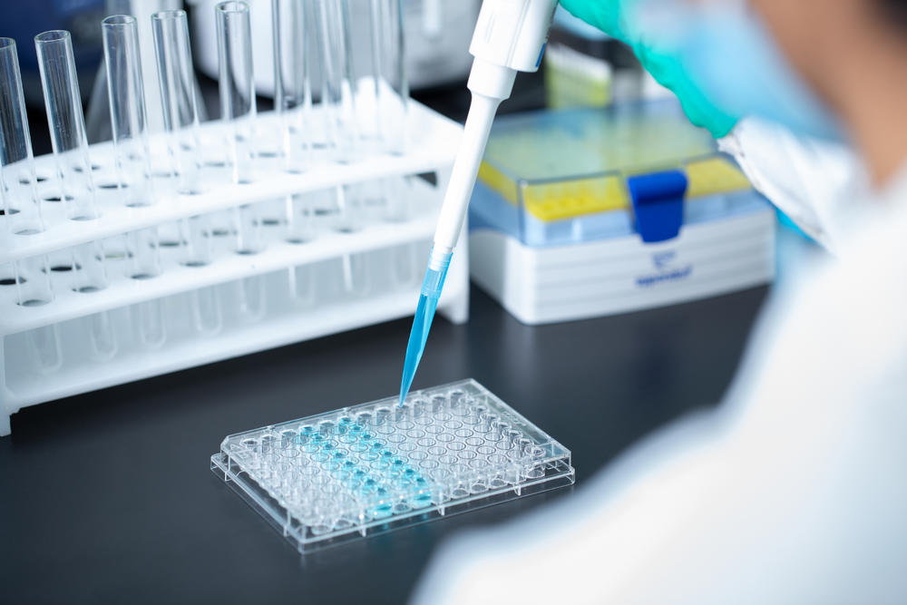 ������ѬȾϵ��